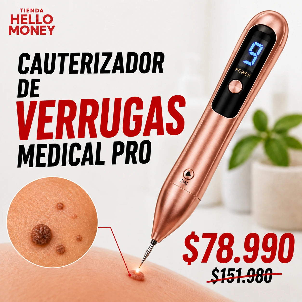 CAUTERIZADOR DE VERRUGAS MEDICAL PRO